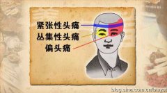 20120412养生堂视频:范吉平讲头痛