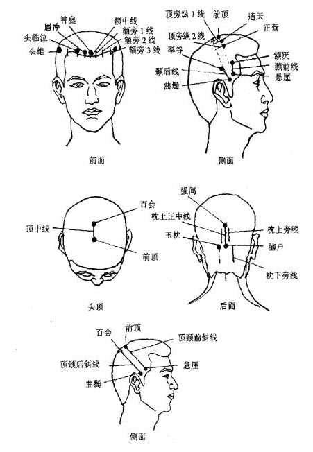 头针穴名标准化方案