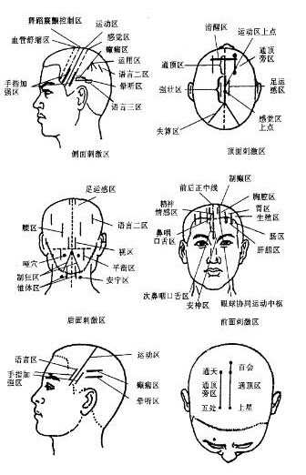 近视眼的主要原因,发病原因,治疗近视眼的