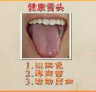 健康的舌头是什么样图片