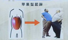 什么是苹果型肥胖图片