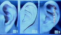 健康的耳朵形状是什么样图片
