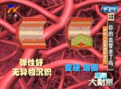 <b>20130908健康大财富视频和笔记:王宏宇讲血管提前老化,粥样斑块</b>