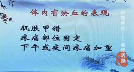 淤血