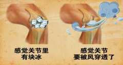 <b>20131210养生堂视频和笔记:吕厚山讲护膝的正确使用,关节痛</b>