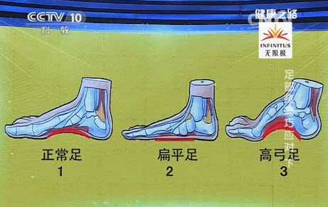 㲿