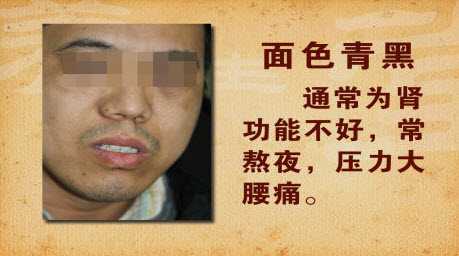 面色如果呈现出青黑色，多预示着肾脏的气不足