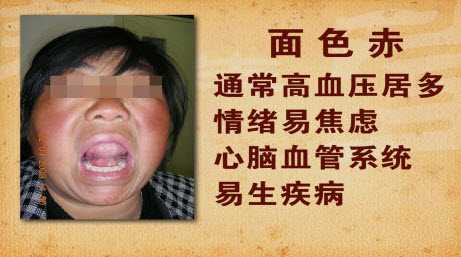 面色如若整个发红，尤其额部发红，多预示着心脑血管不好