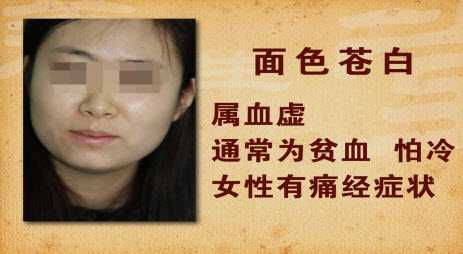 面色如若苍白，则一般预示着血虚