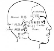 中医针灸调治耳鸣耳聋图片