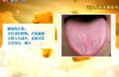 20140402贵州卫视养生视频和笔记：罗大伦讲看舌苔解决寒湿湿热症
