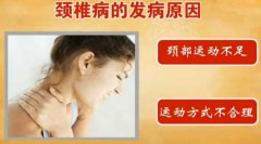 赵之心讲颈椎病的发病原因及防治方法图片