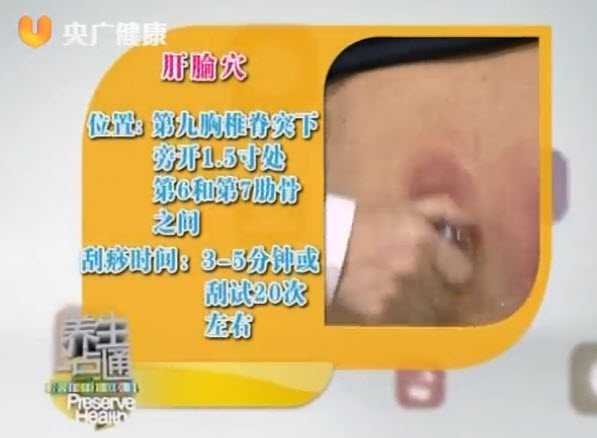 乳腺增生高发人群