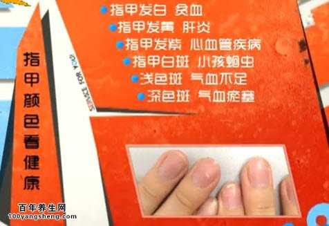 指甲颜色透露的疾病征兆