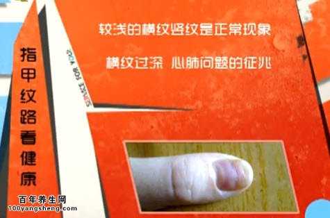 指甲纹路看健康