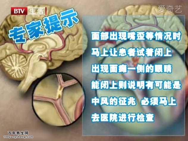 专家支招
