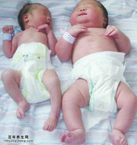 200斤产妇产巨婴