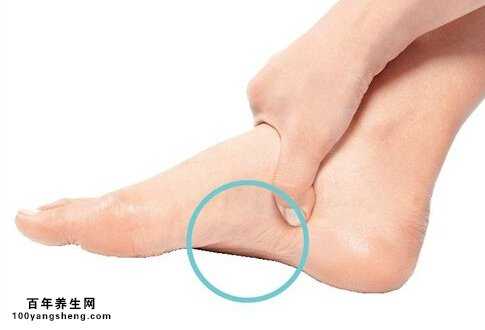 脚肿