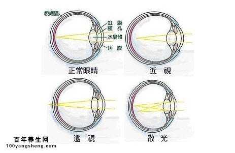 远视