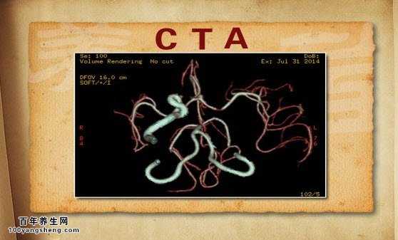 CTA