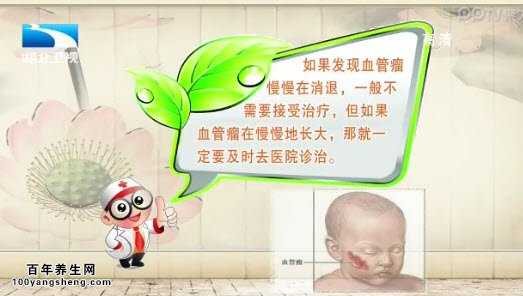 血管瘤的治疗