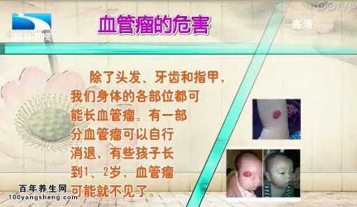 血管瘤的危害