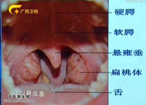 扁桃体的位置