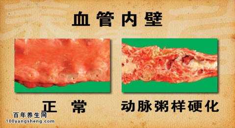 血管内壁