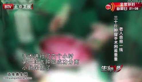 杨志英为患者保住小肠