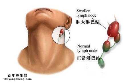 脖子上的淋巴位置图