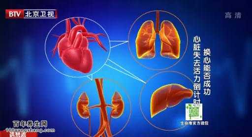 换心手术