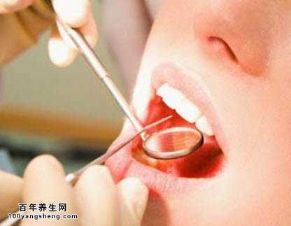 口腔癌