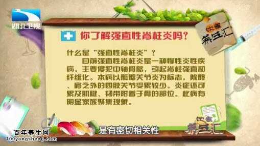 强直性脊柱炎