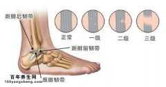 急性踝扭伤的辨证要点和基本治疗方法有哪些