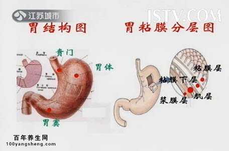 胃结构图