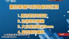 <b>20150903X诊所视频和笔记:刘天一,基底细胞癌,黑色素瘤,防晒指数</b>