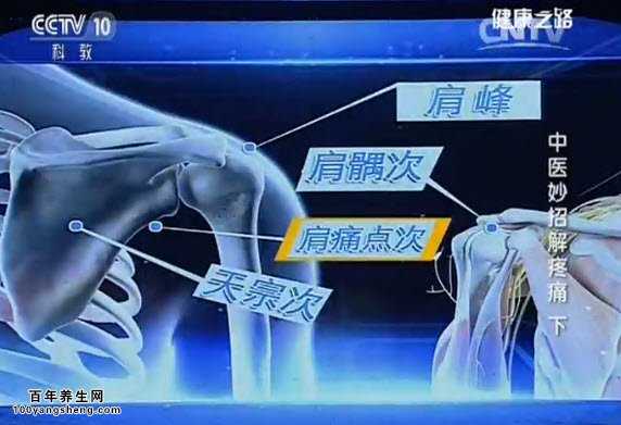 肩膀疼的结筋点