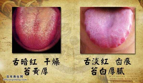 舌象