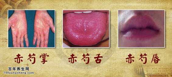 肝热人群