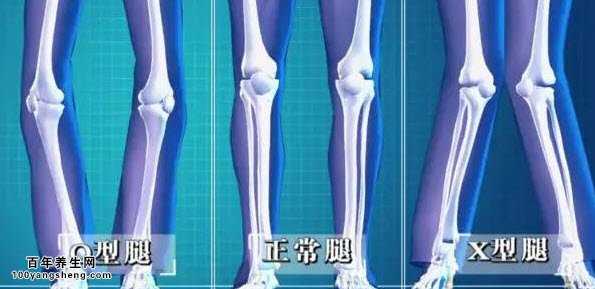 腿型