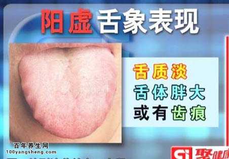阳虚的舌象表现