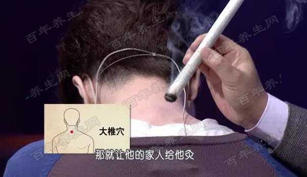 大椎穴