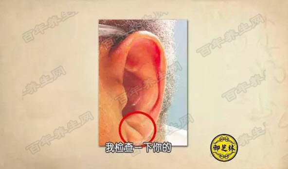 冠脉沟