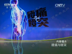 20160311健康之路视频和笔记:朱宏伟,腰痛,腰突,腰椎间盘突出