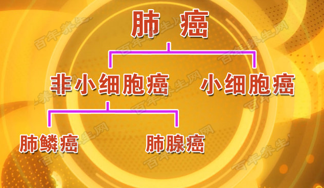 肺癌的亚型