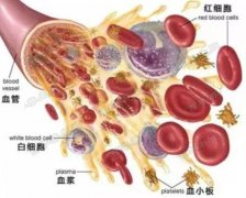 20160804我是大医生视频和笔记:孟莉,红细胞,血小板,水杨酸,血癌
