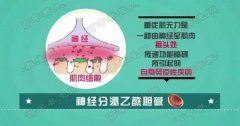 20160910饮食养生汇视频和笔记:李燕,重症肌无力,服药的禁忌