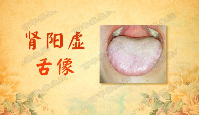 肾阳虚的舌像