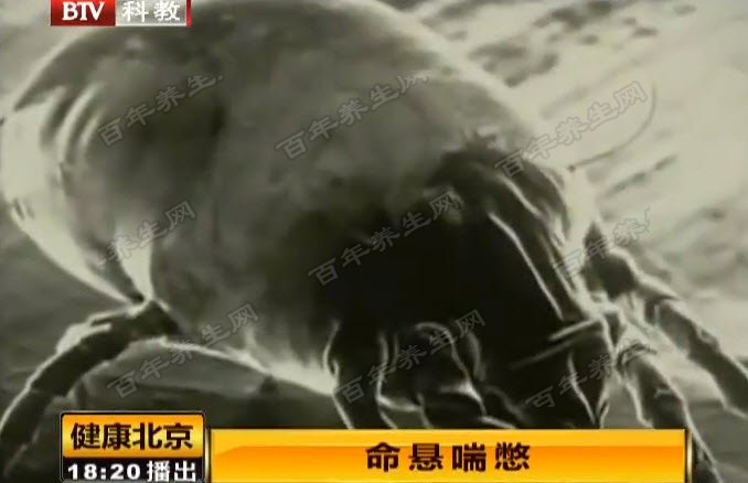 螨虫