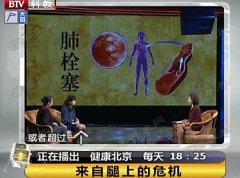 20170216健康北京视频和笔记:王晶,深静脉血栓,肺栓塞,腿肿